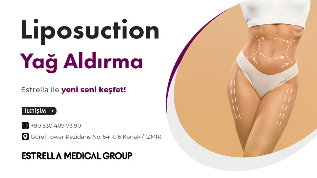 liposuction ameliyatı